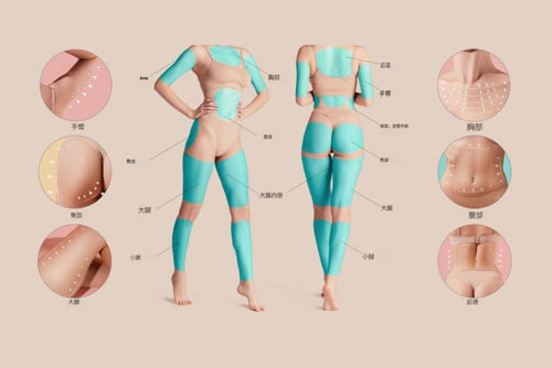 吸脂部位圖