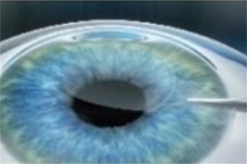 全飛秒分離基質(zhì)層