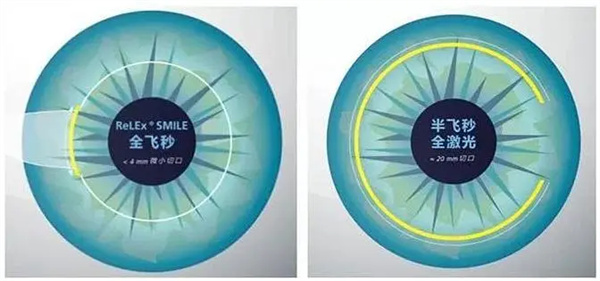 全飛秒半飛秒激光照片