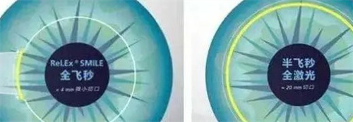 全飛秒和半飛秒