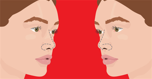 鼻部形態(tài)示意圖