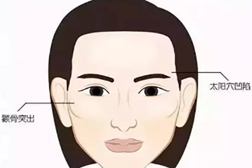 面部輪廓問題示意圖