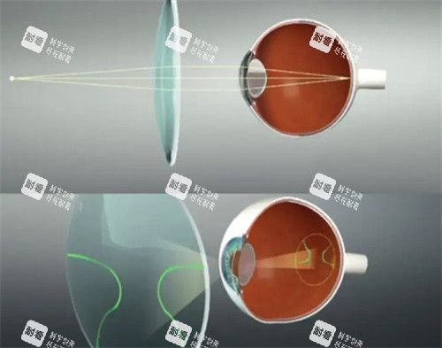 漸進鏡片技術(shù)