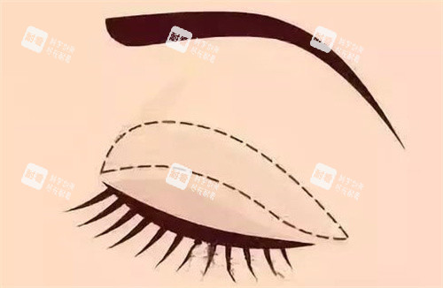 青島燦辰醫(yī)療美容診所怎么樣？醫(yī)生正規(guī)審美在線，術(shù)后護(hù)理貼心，醫(yī)美選它超靠譜