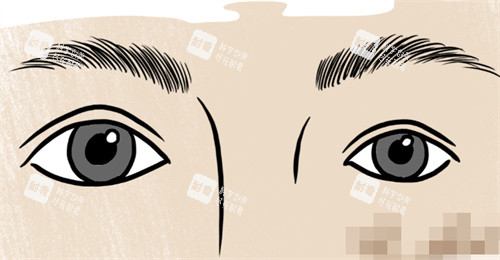 上海馬娟修復(fù)眼睛費(fèi)用：基礎(chǔ)修復(fù)8000元起，高難度修復(fù)15000元起