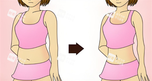 吸脂對(duì)比圖