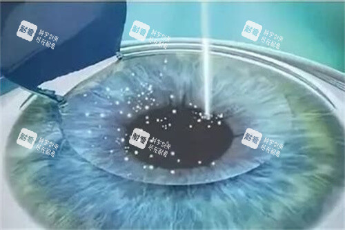 北京普瑞華德眼科預(yù)約掛號(hào)超簡(jiǎn)單！線上快速對(duì)接，不耽誤看眼