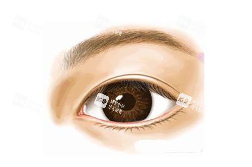 真實雙眼皮示意圖