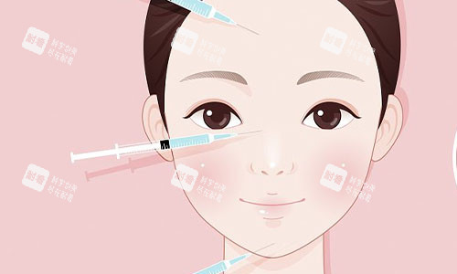 注射美容的部位示意圖