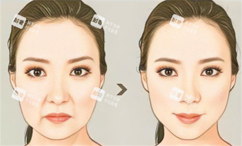 面部抗衰對(duì)比 面部抗衰對(duì)比