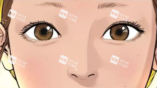 自然雙眼皮 自然雙眼皮