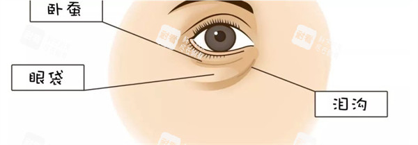 眼部臥蠶眼袋淚溝位置示意圖