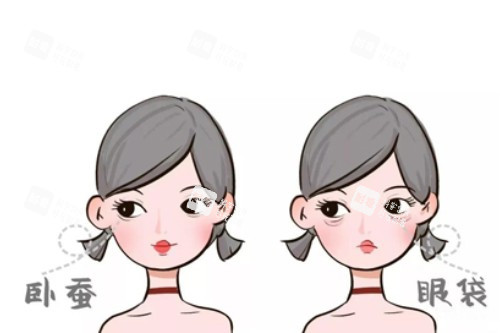 臥蠶、眼袋卡通對比圖
