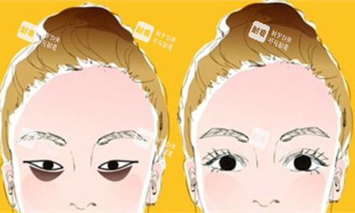 眼袋明顯對比圖