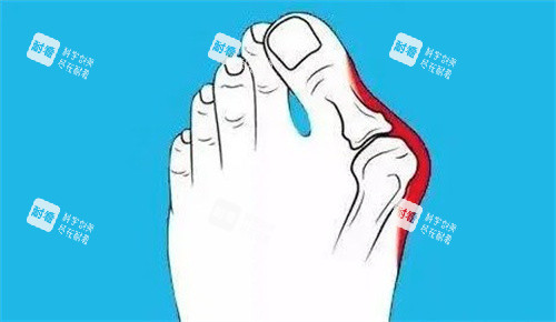 大腳骨是什么 大腳骨是什么