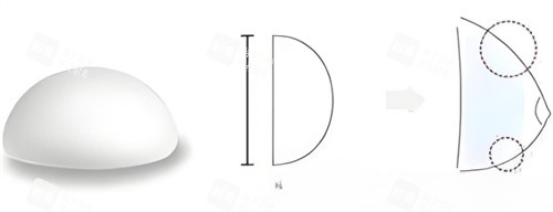 假體隆胸圓形 假體隆胸圓形