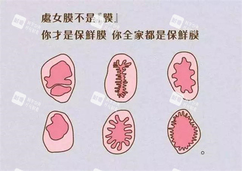 處女膜形狀動(dòng)畫(huà)演示圖 處女膜形狀動(dòng)畫(huà)演示圖