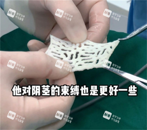 陰莖生物補(bǔ)片材料樣子