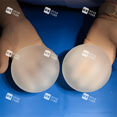 隆胸手術(shù)硅膠假體圖