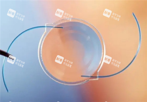 白內障晶體照片