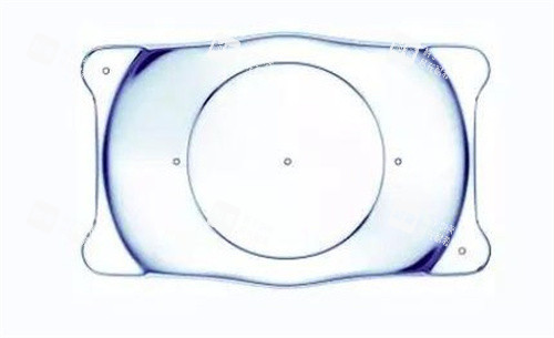 什么是ICL人工晶體