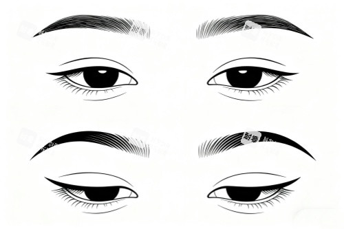 割雙眼皮成果展示