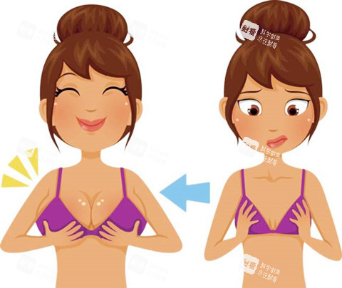 自體脂肪隆胸卡通圖