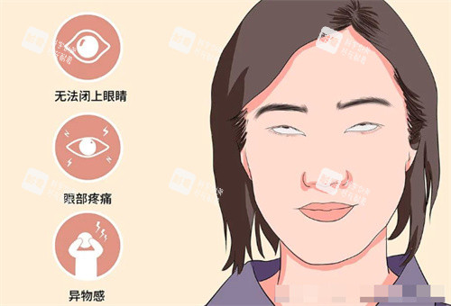 需要做眼修復的情況