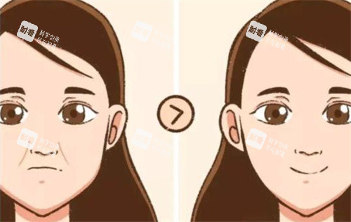 法令紋前后對(duì)比