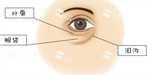 臥蠶眼袋和淚溝位置