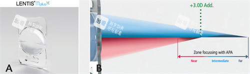 荷蘭Oculentis人工晶體原理 荷蘭Oculentis人工晶體原理