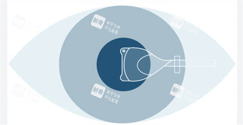 人工晶體植入手術(shù)圖示 人工晶體植入手術(shù)圖示