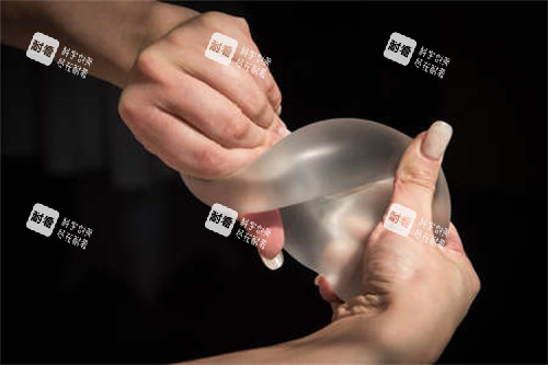 隆胸假體扭曲圖示