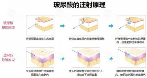 鄭州正美醫(yī)療美容怎么樣？正規(guī)資質(zhì)+千級層流手術(shù)室|技術(shù)口碑雙認(rèn)證|地址在經(jīng)八路28號