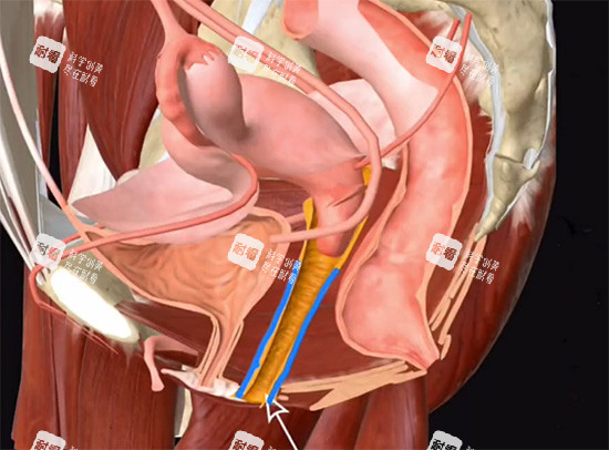 陰道緊縮針動畫原理