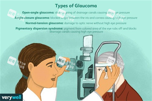 青光眼的類(lèi)型