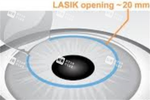 半飛秒制瓣示意圖