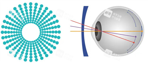 奧拉怒放離焦鏡片原理