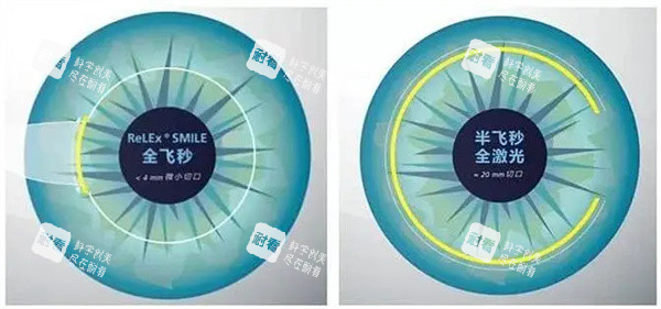 全飛秒半飛秒激光照片
