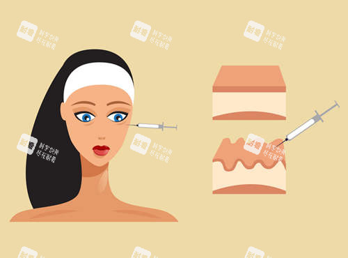 注射美容圖示