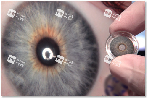 人工虹膜晶體實物