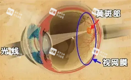 黃斑眼病的發(fā)病位置圖解