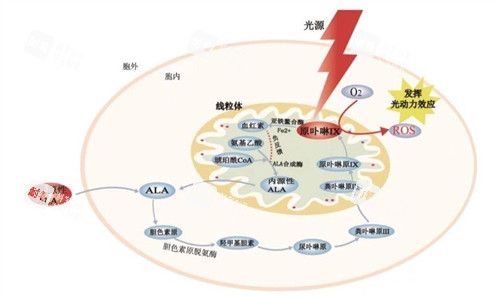 光動(dòng)力治療黃斑眼病原理圖解