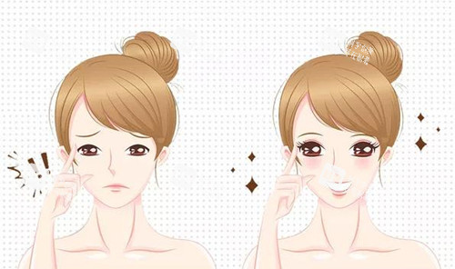 雙眼皮術(shù)宣傳圖