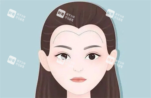 南昌國丹植發(fā)收費價目表查詢，含頭頂加密植發(fā)/ 發(fā)際線植發(fā)/疤痕種植等費用！