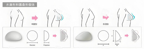 假體隆胸形狀對比