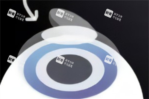 半飛秒制作角膜瓣