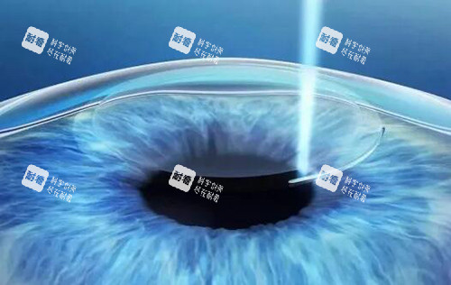 飛秒激光展示圖