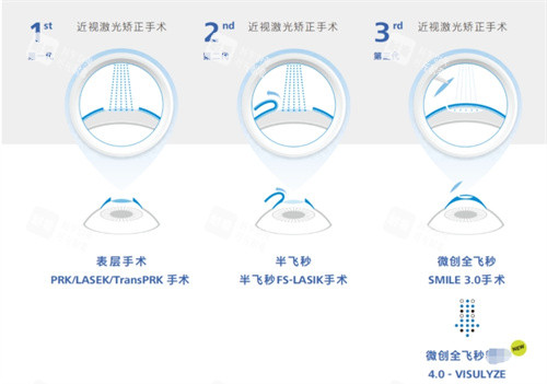 全飛秒4.0技術與其他技術對比