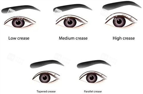 洛陽割雙眼皮哪家強？孔繁榮/華美/締萊美等7家醫(yī)院實力對比